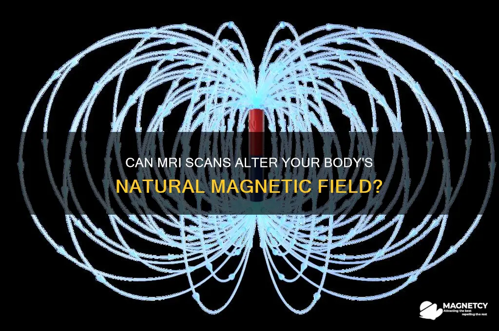 can mri change body