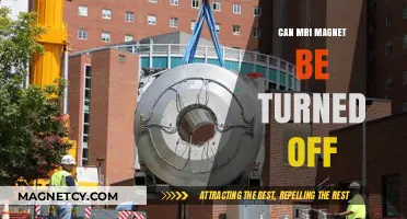 Can MRI Magnets Be Turned Off? Exploring Safety and Functionality