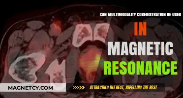 Exploring Multimodality Coregistration in Magnetic Resonance Imaging Applications