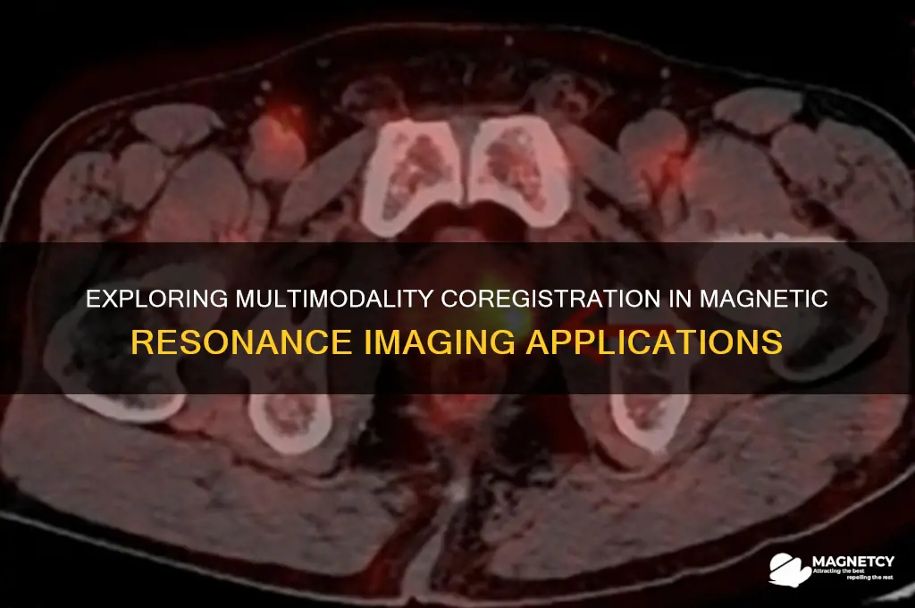 can multimodality coregistration be used in magnetic resonance