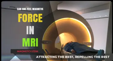 Can You Feel Magnetic Force During an MRI Scan?