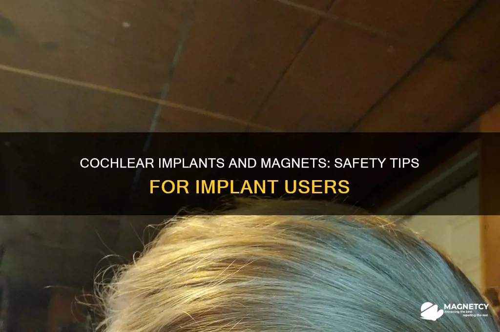 can people with cochlear implants be near magnets