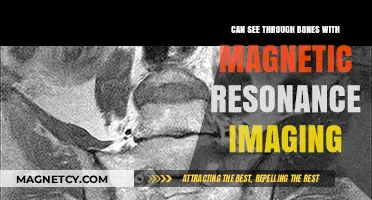 Unveiling the Invisible: MRI's Revolutionary Ability to See Through Bones