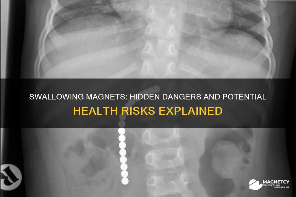 can swallowing a magnet be dangerous