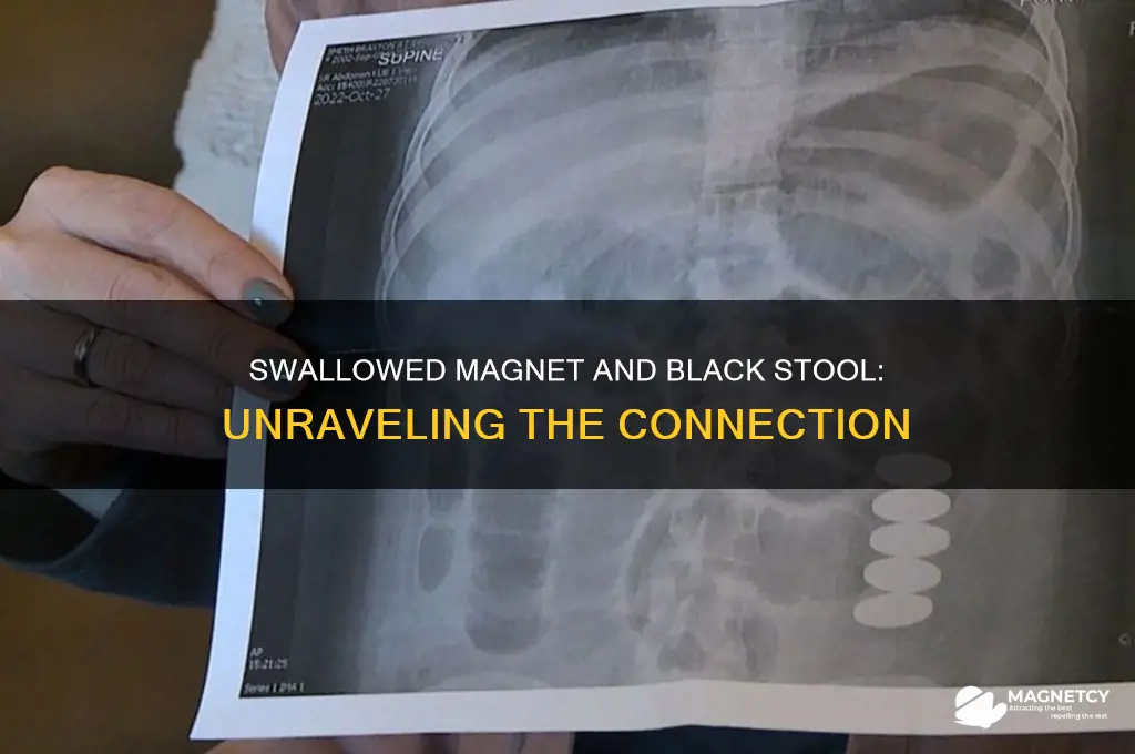 can swallowing a magnet cause black stool