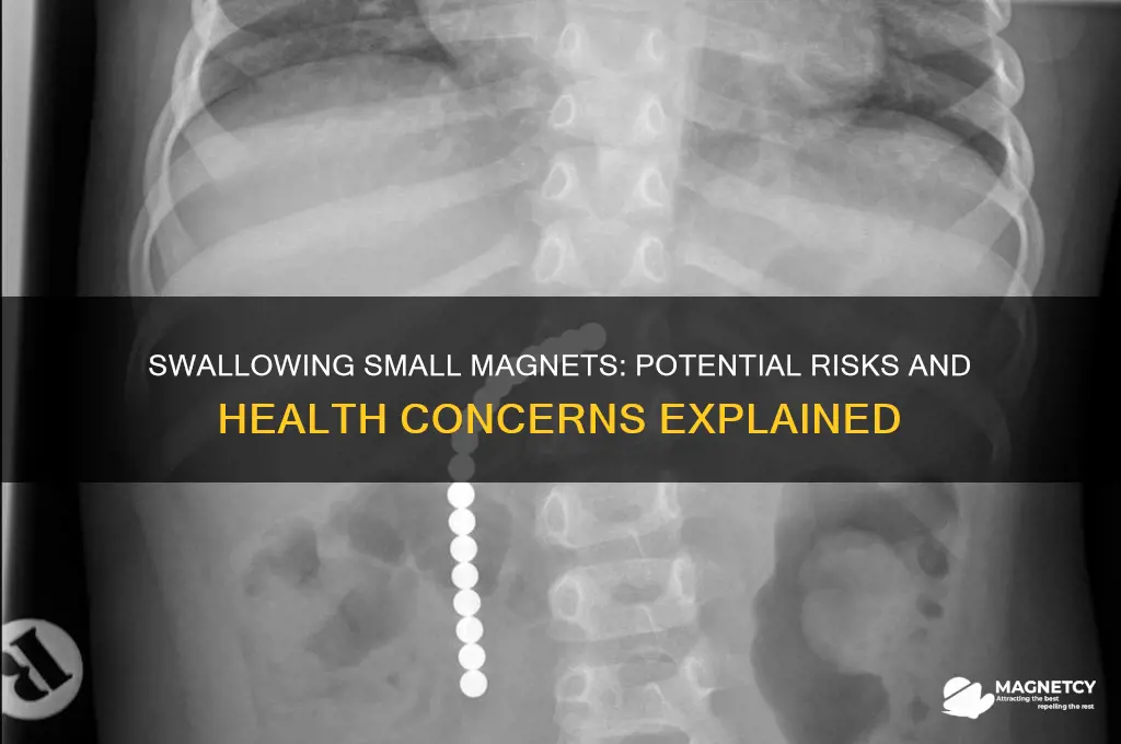 can swallowing a small magnet hurt you