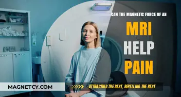 Exploring MRI's Magnetic Force: A Potential Non-Invasive Pain Relief Solution