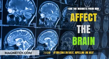 Exploring the Impact of MRI Magnets on Brain Health