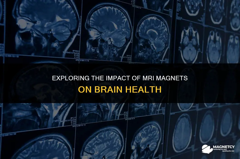 can the magnets from mri affect the brain