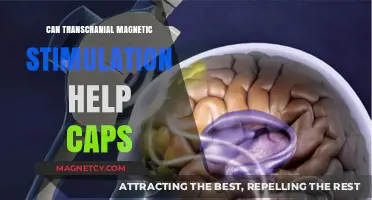 Exploring TMS Therapy: A Potential Solution for Chronic Pain Relief