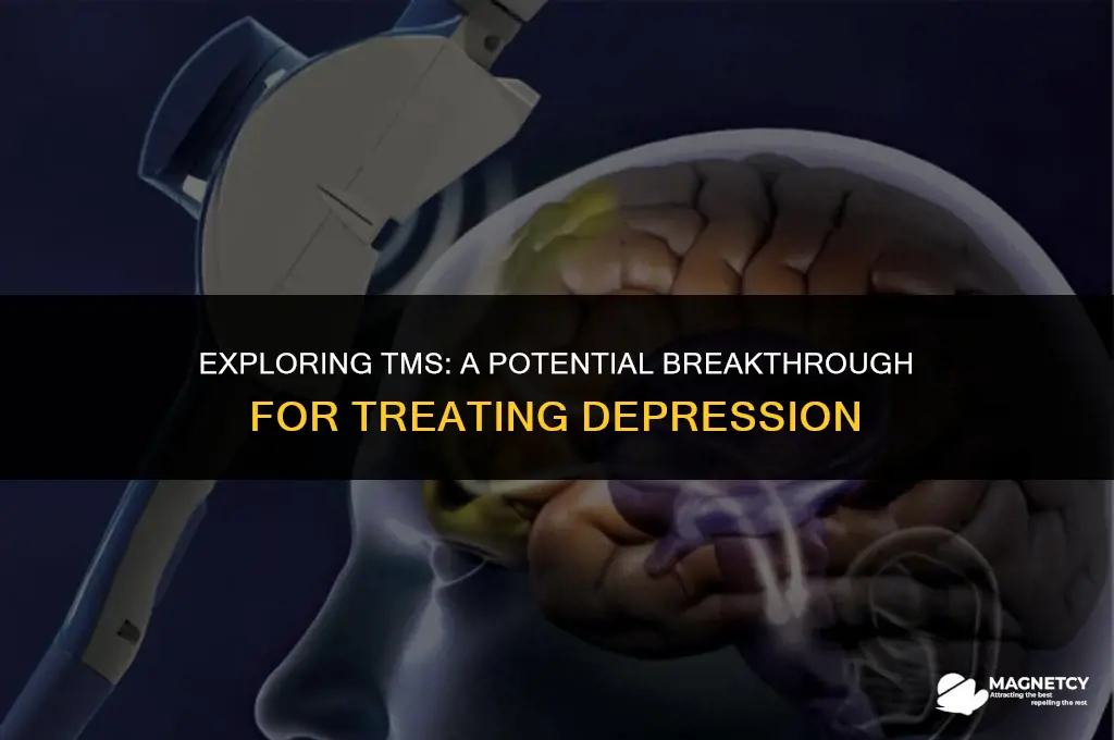 can transcranial magnetic stimulation work for depression