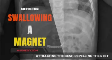 The Dangers of Swallowing Magnets: A Deadly Risk Explained