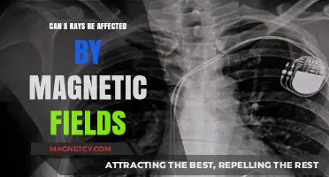 Exploring the Impact of Magnetic Fields on X-Ray Imaging