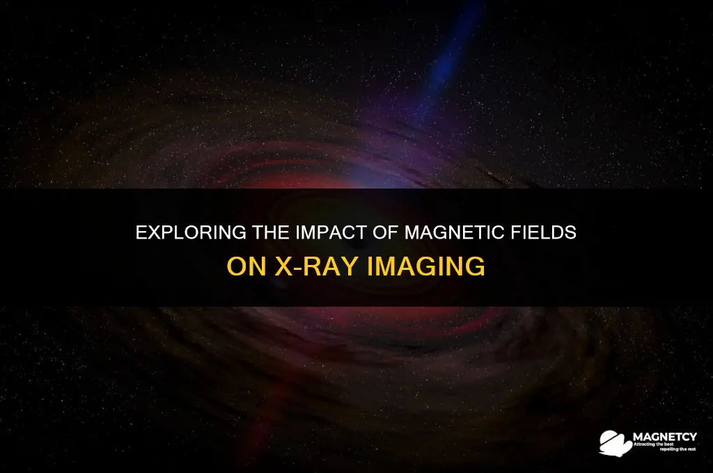 can x rays be affected by magnetic fields