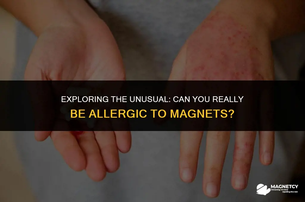 can you be allergic to magnets