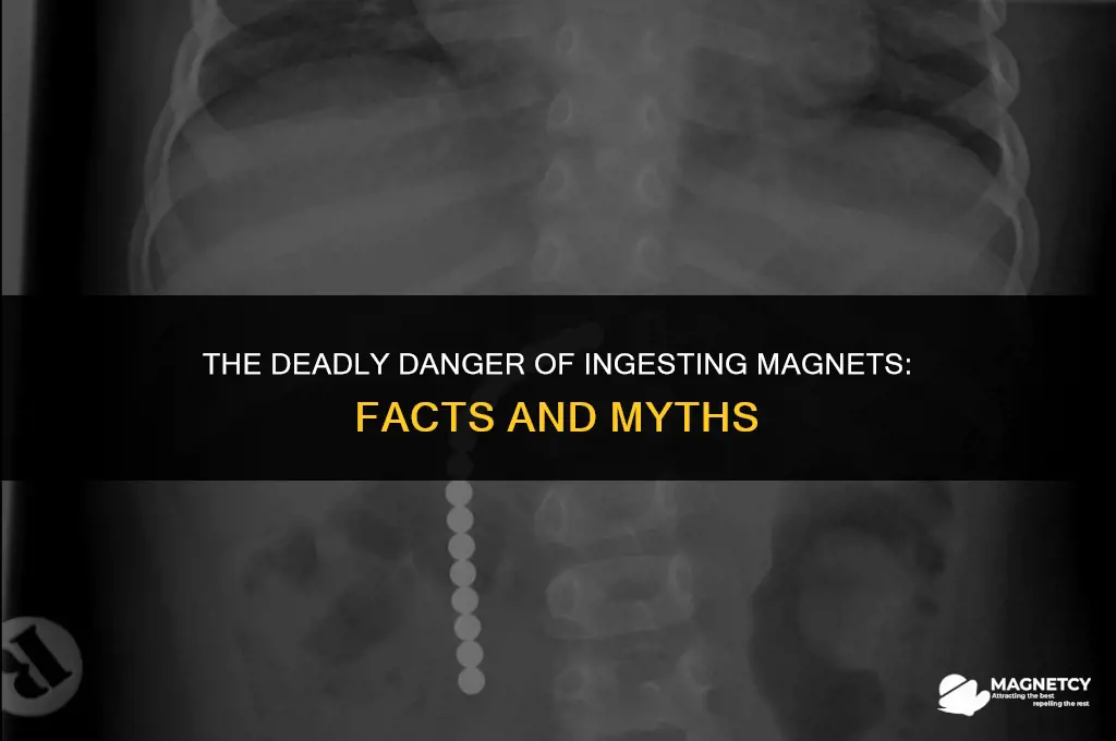 can you die from eating a magnet