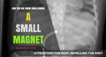 The Dangers of Swallowing Small Magnets: A Deadly Risk?