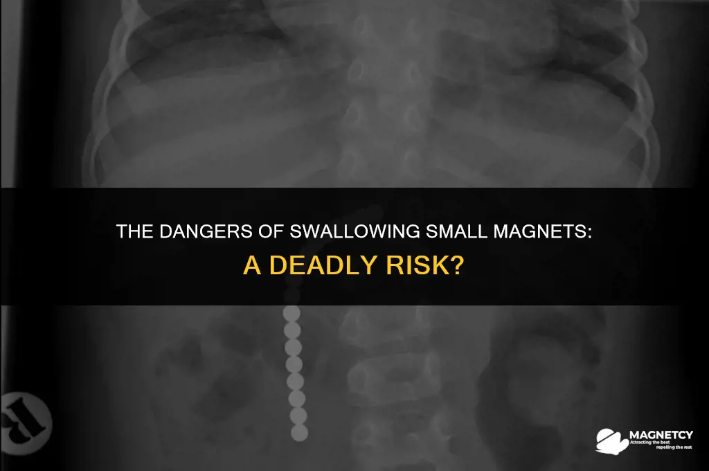 can you die from swallowing a small magnet