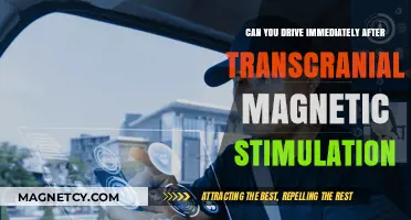 Exploring TMS: Can You Drive Right After Transcranial Magnetic Stimulation?