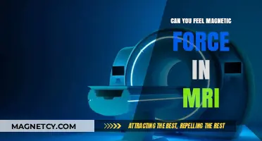 Exploring the Sensations of MRI: Can You Feel Magnetic Force?