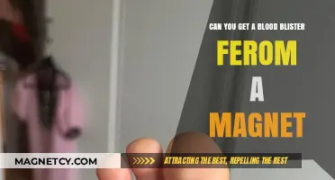 Exploring the Myth: Can Magnets Really Cause Blood Blisters?