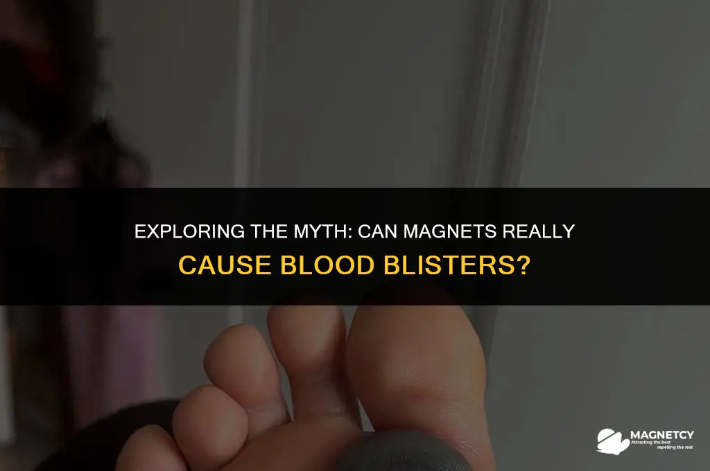 can you get a blood blister ferom a magnet