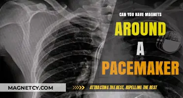 Magnets and Pacemakers: What You Need to Know
