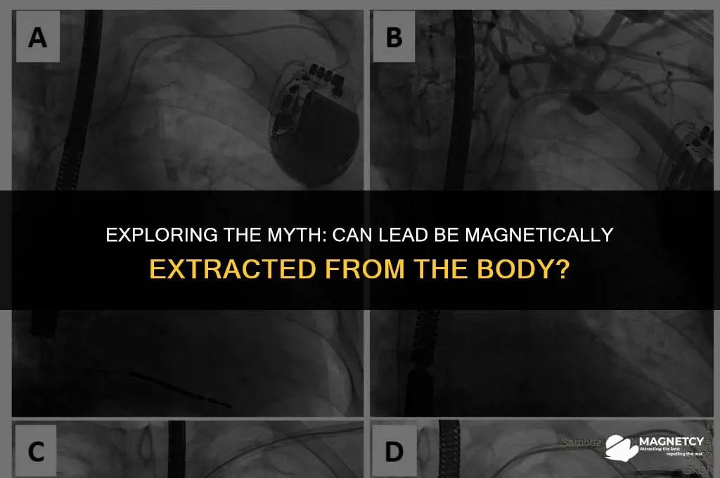 can you magnetically extracted lead from the body