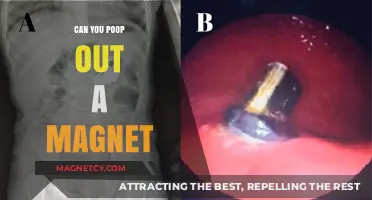 Exploring the Curious Case of Magnet Ingestion and Elimination