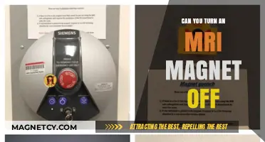 Exploring the Safety and Functionality of MRI Magnet Shutdowns