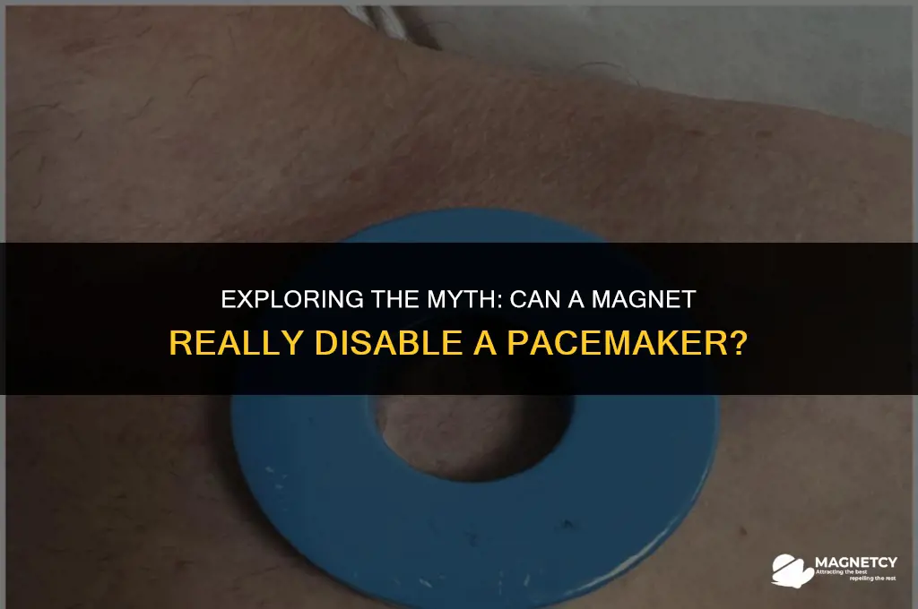 can you turn off a pacemaker with a magnet