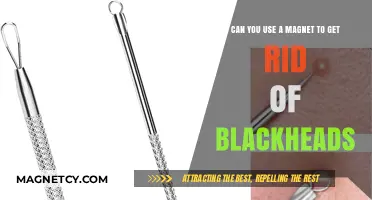 Magnet Blackhead Removal: Effective Solution or Myth?