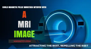 Exploring the Impact of Magnetic Pulse Induction on MRI Imaging