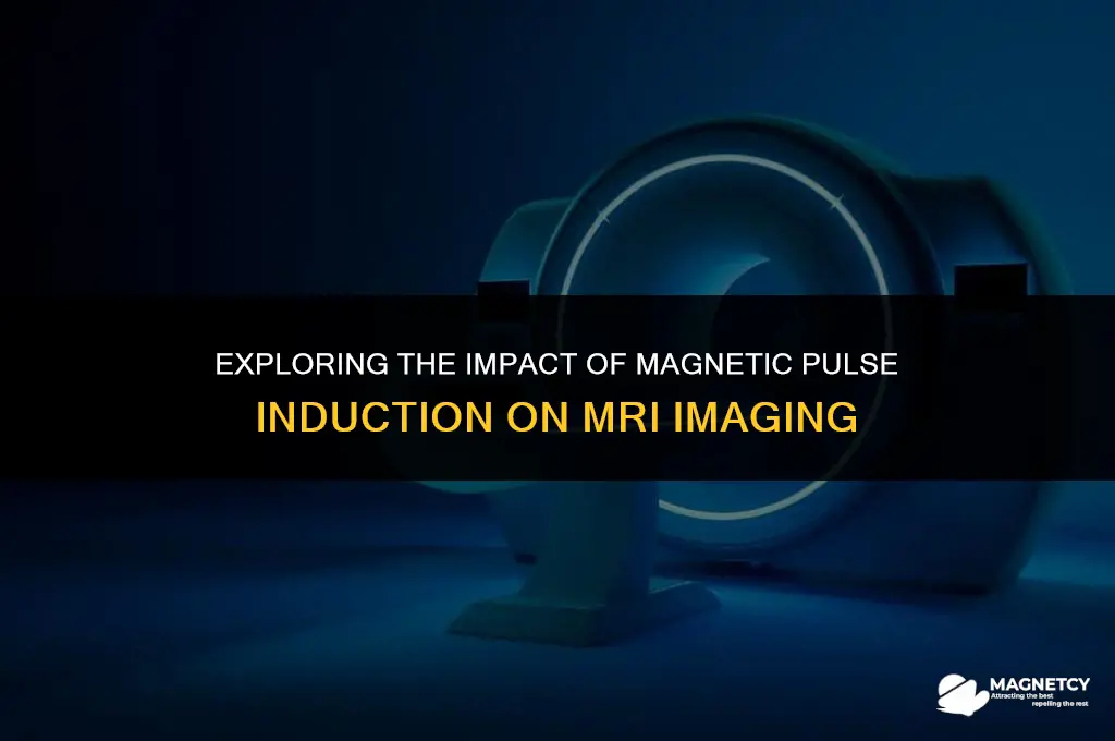 could magnetic pulse induction interfer with a mri image