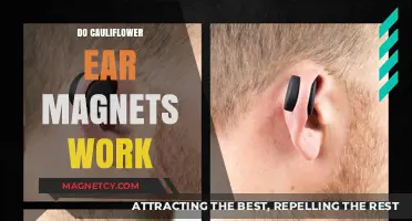 Exploring the Effectiveness of Cauliflower Ear Magnets: Facts and Myths