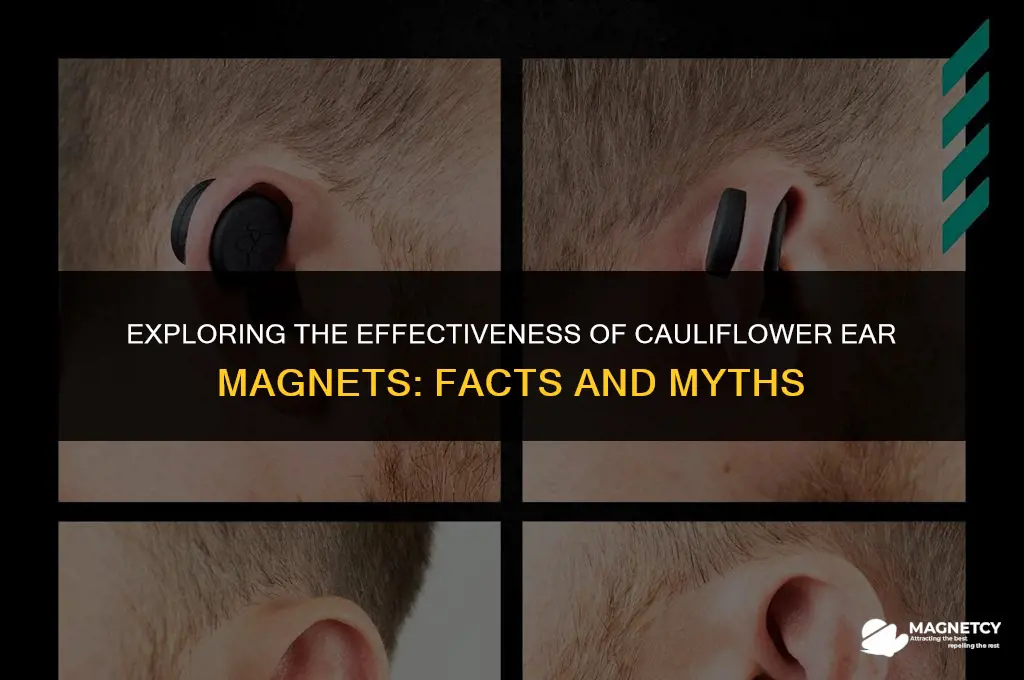 do cauliflower ear magnets work