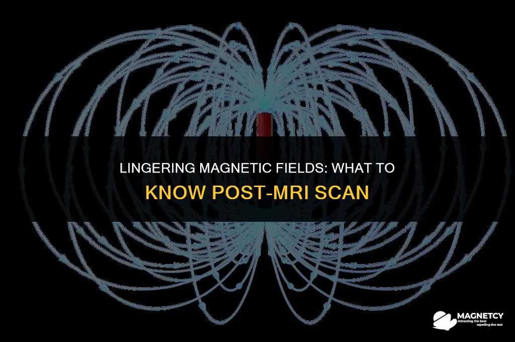do i have a residual magnetic field after an mri
