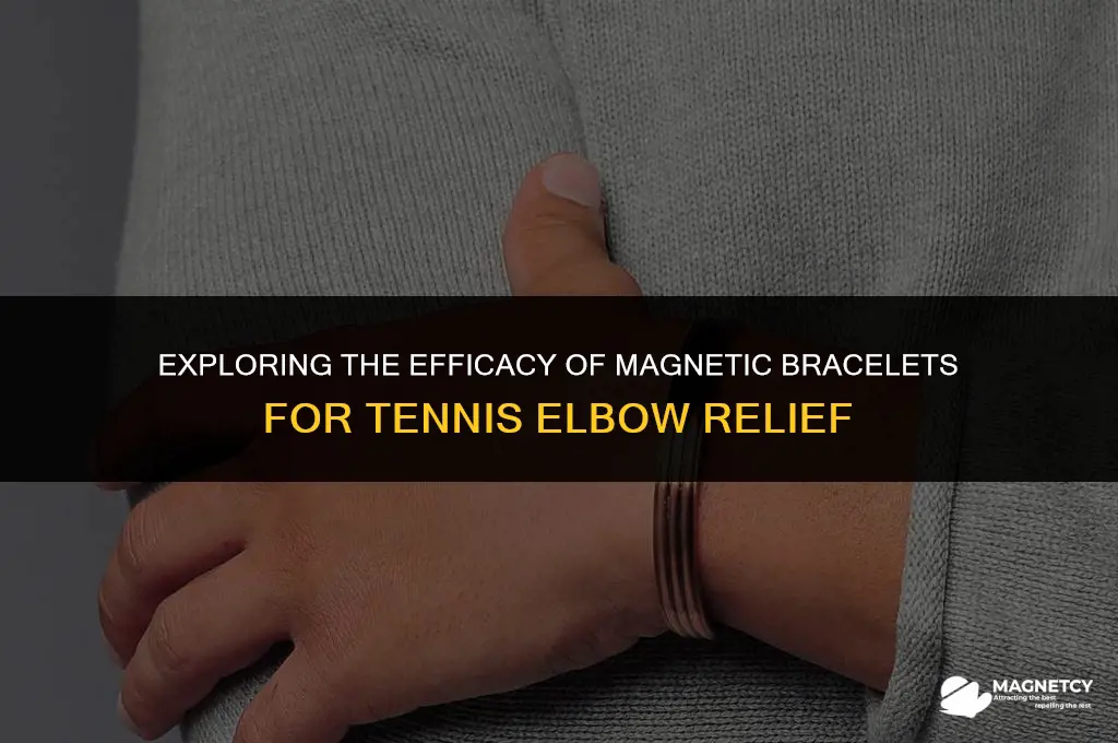 do magnetic bracelets work for tennis elbow