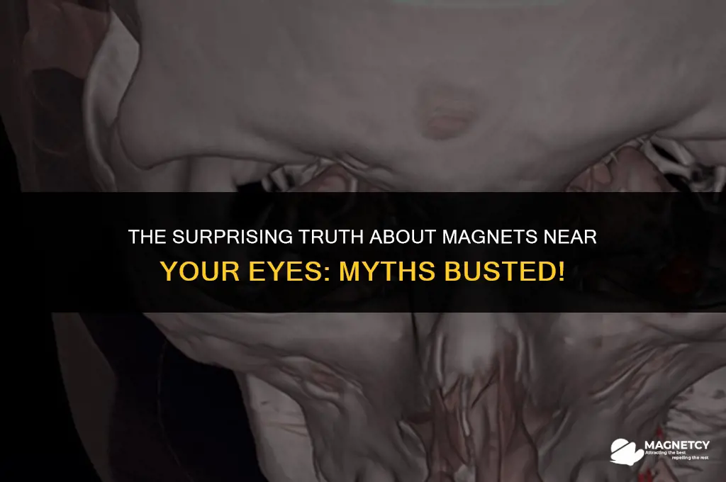 do magnets close to eyes cause problems