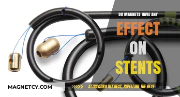 Exploring the Interaction: Do Magnets Affect Stents?