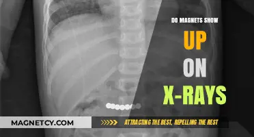 Unveiling the Mystery: Do Magnets Appear on X-Rays?