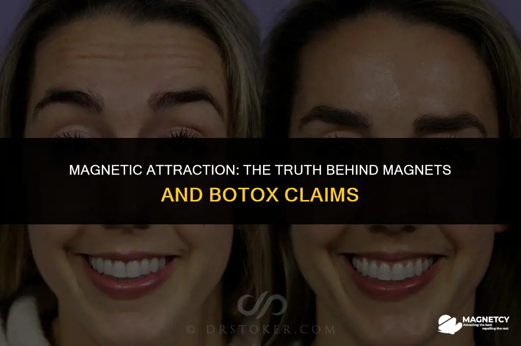 do magnets work like botox