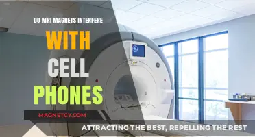 Exploring the Impact of MRI Magnets on Cell Phone Functionality