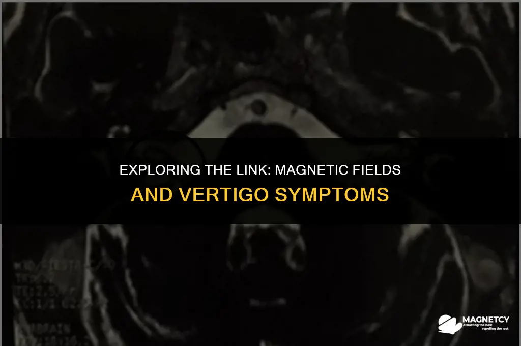 do some people have vertigo because of magnetic field