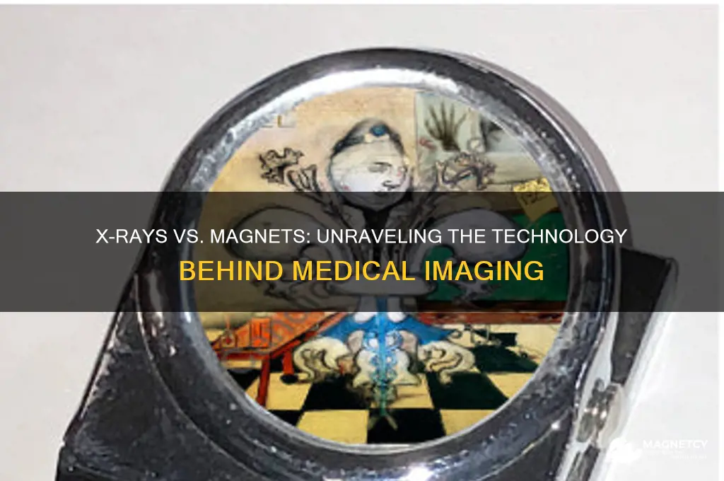 do xray use magnet