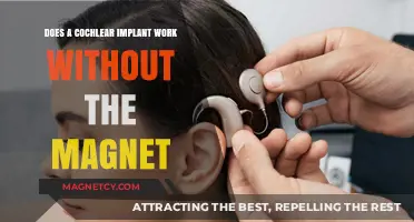 Cochlear Implants: Functionality Beyond the Magnet's Role