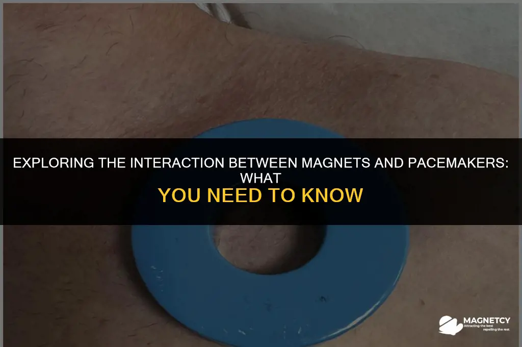 does a magnet make a pacer make go off