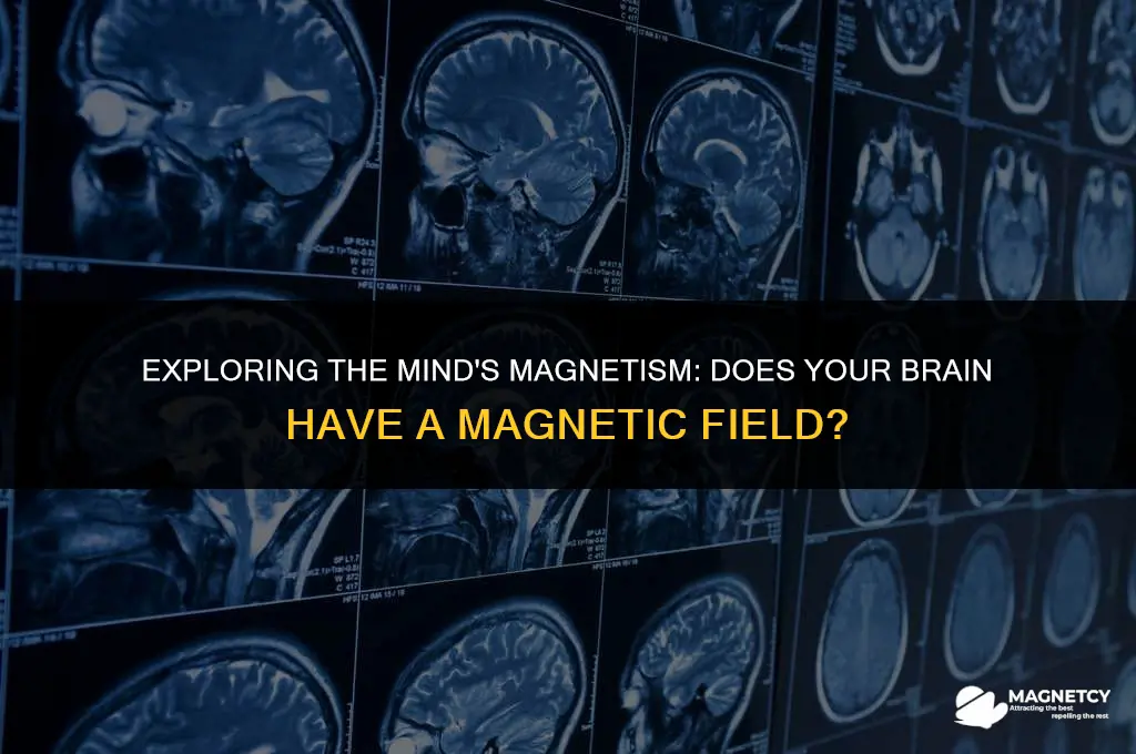 does brain have magnetic field