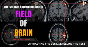 Exploring the Precision of fMRI: Does It Measure Magnetic Field Distortions in the Brain?