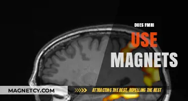 How fMRI Utilizes Powerful Magnets to Map Brain Activity